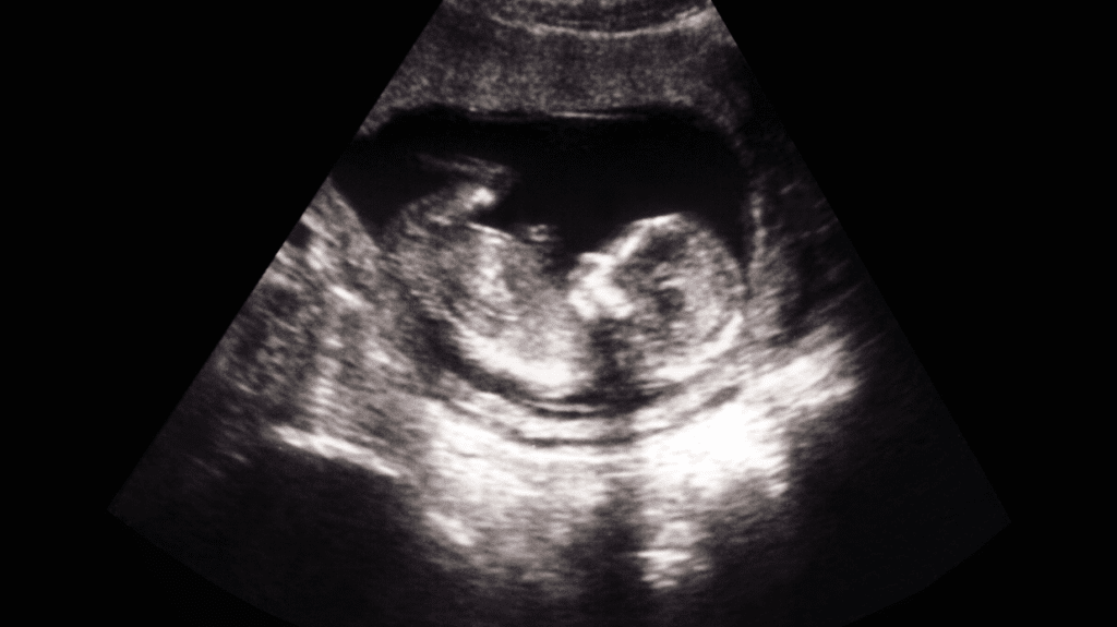 ultrasound gestation period