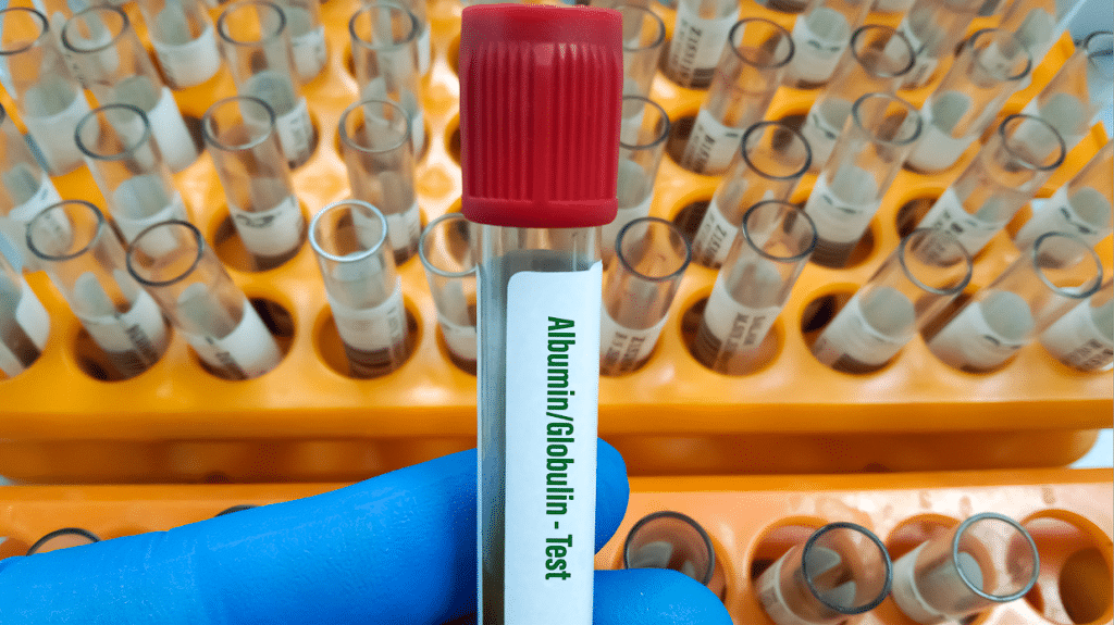 urine albumin to creatinine ratio